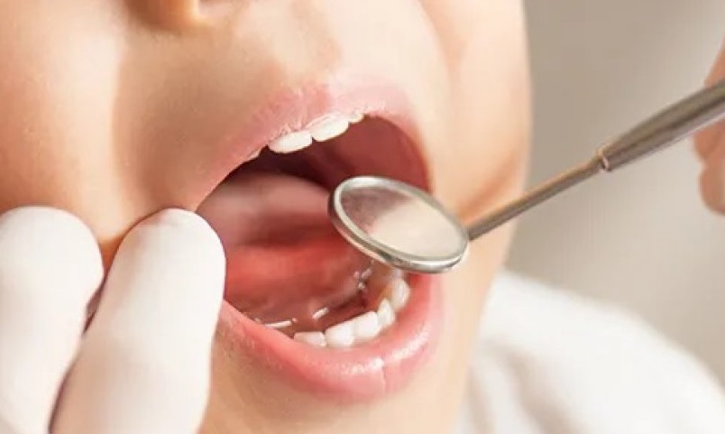 Ηράκλειο Αττικής: Δωρεάν οδοντιατρικό έλεγχο σε όλα τα παιδιά που συμμετέχουν στο φετινό προγράμμα CAMP του Δήμου